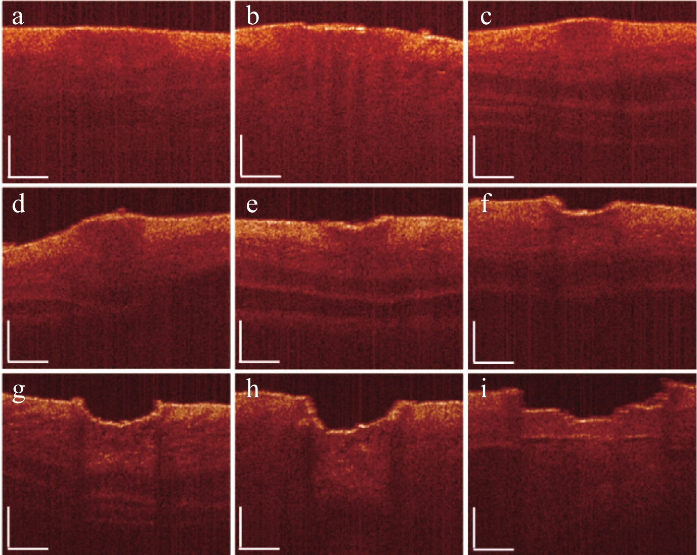 1064 nm激光不同辐照时间对小鼠皮肤热损伤的实验与理论研究